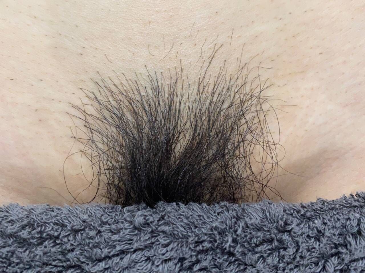 【お写真有り◎】VIO施術体験って何するの？詳しく解説！！