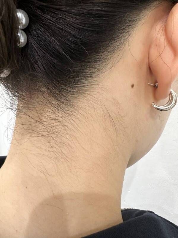 【BeforeAfterのお写真有り◎】うなじ脱毛で快適な夏を★